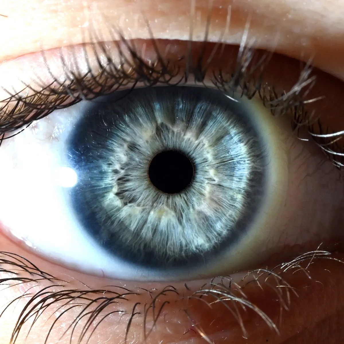 Close-up of a pale blue iris with a lighter ring around the pupil