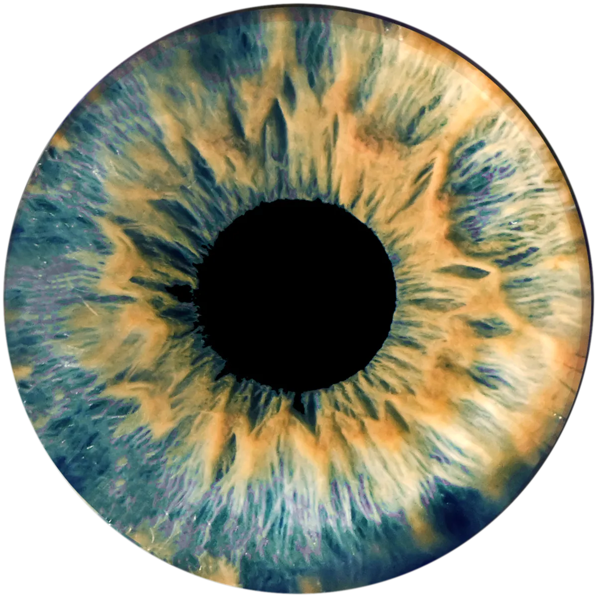 A blue and orange iris after retouching, shown as a circle